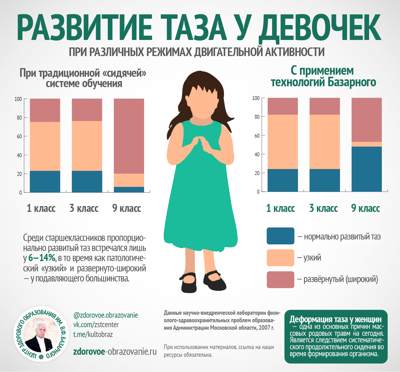 Инфографика: развитие таза у школьниц