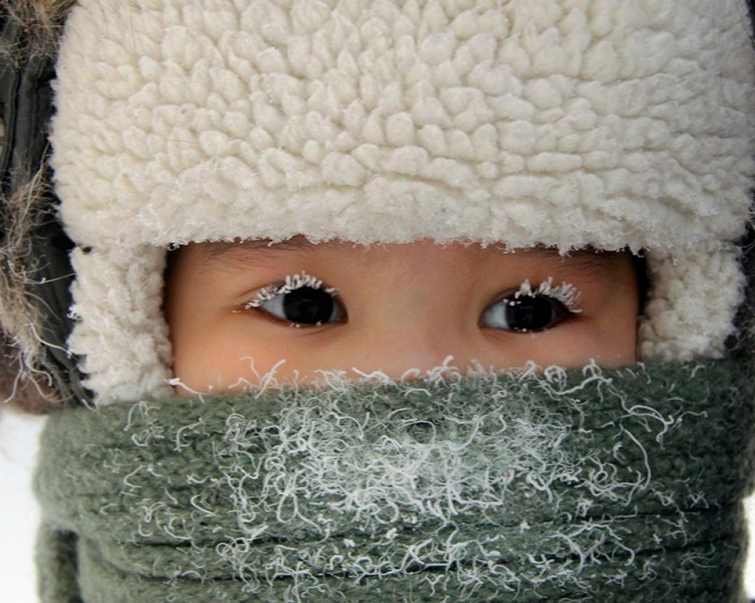 Состояние органа зрения у детей коренных народностей Севера